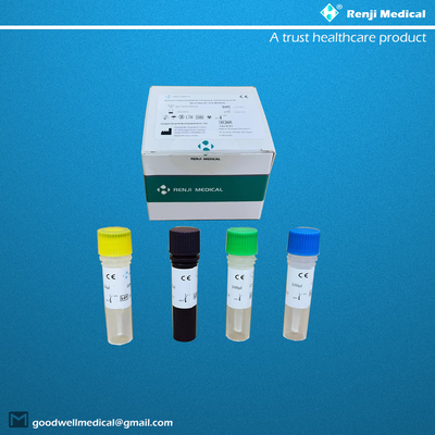 Test qualitatif Rt Pcr CE du nouveau kit de test d'acide nucléique du coronavirus COVID-19