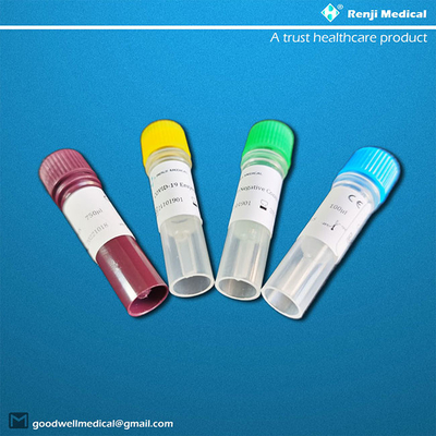 Approbation en temps réel de la méthode ISO13485 de Renji Nucleic Acid Testing Kit RT-PCR