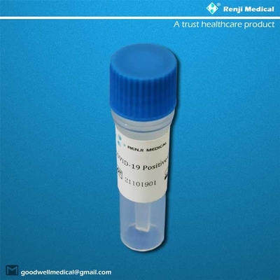 Essai Kit Oropharyngeal Nasopharyngeal de maison de la sensibilité Sars-Cov-2 de 95%